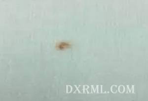 麵料染色成品產生鏽斑