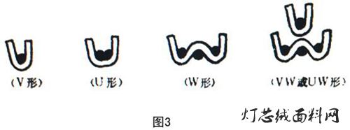 50%体育首存红利~
絨毛的固結方式